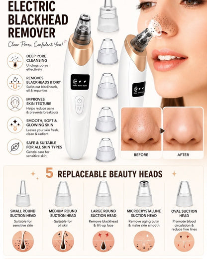 Electric Pore Vacuum Cleaner – Deep Pore & Blackhead Remover