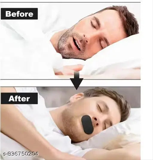 NasoRest™ Sleep Strips – Gentle Mouth Tape for Nighttime Nasal Breathing